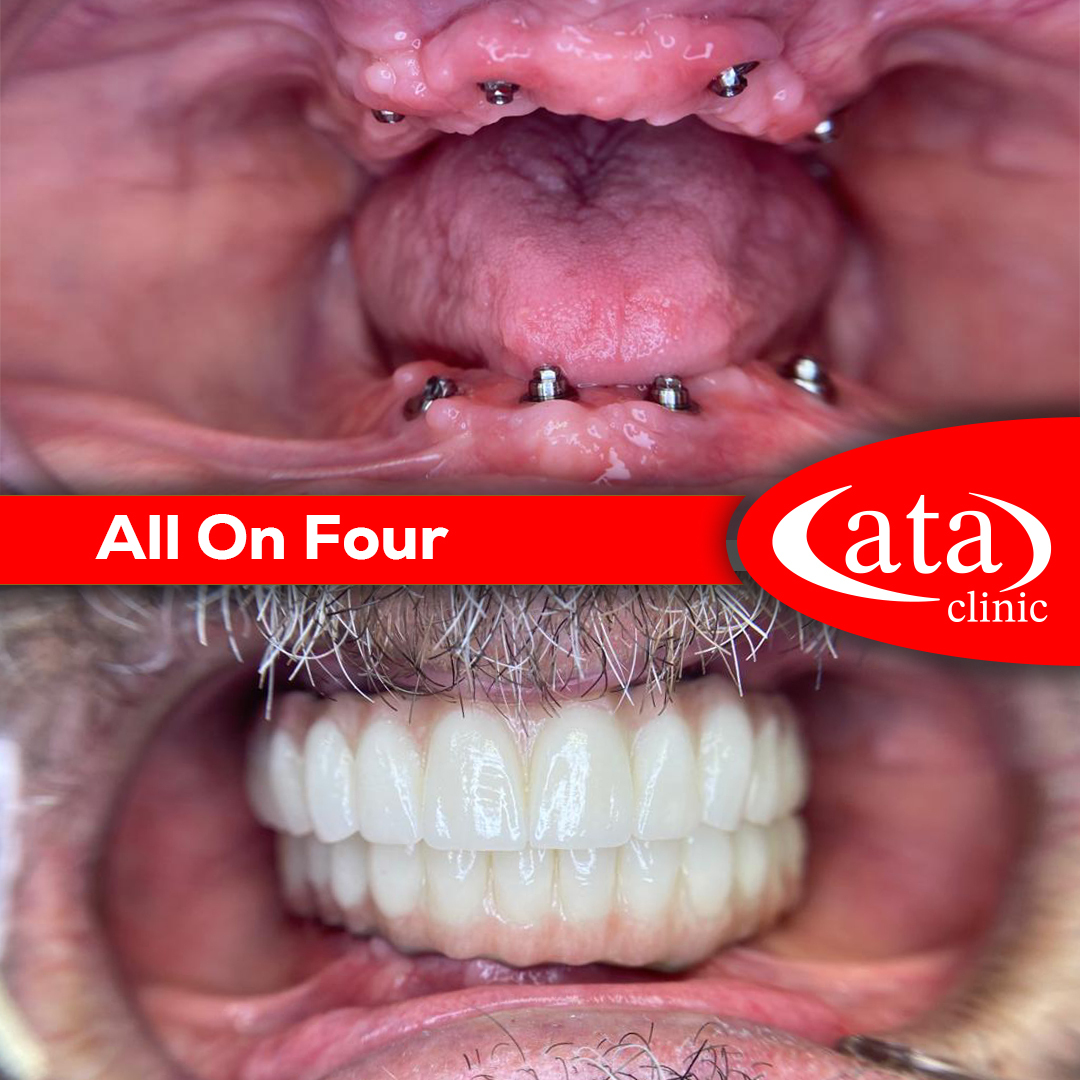 Ata ConfiDental photo 1