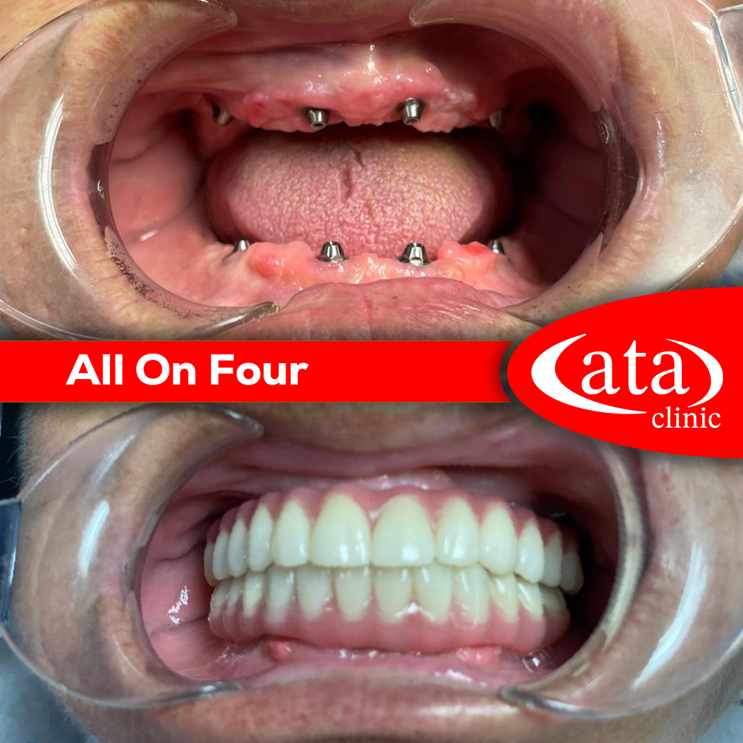 Ata ConfiDental photo 2