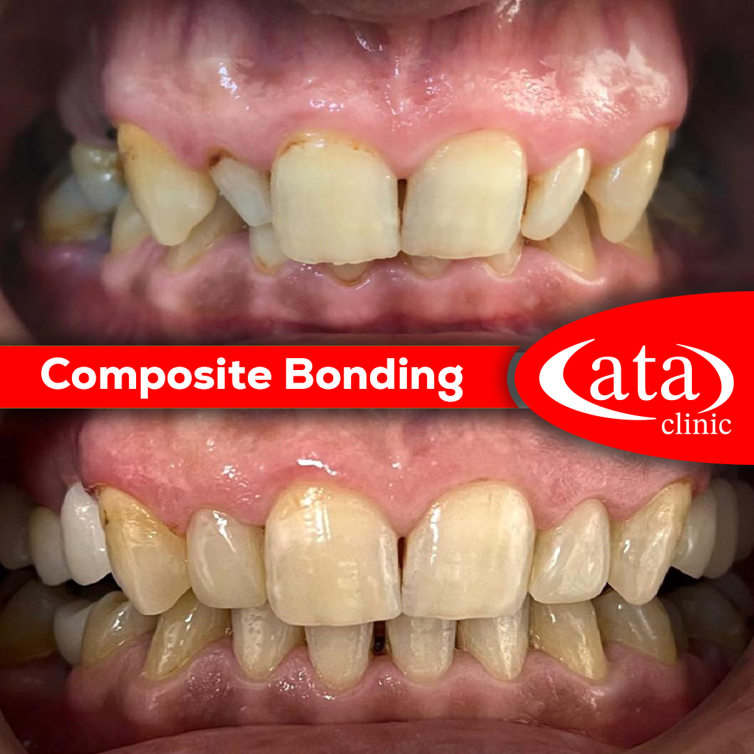 Ata ConfiDental photo 3