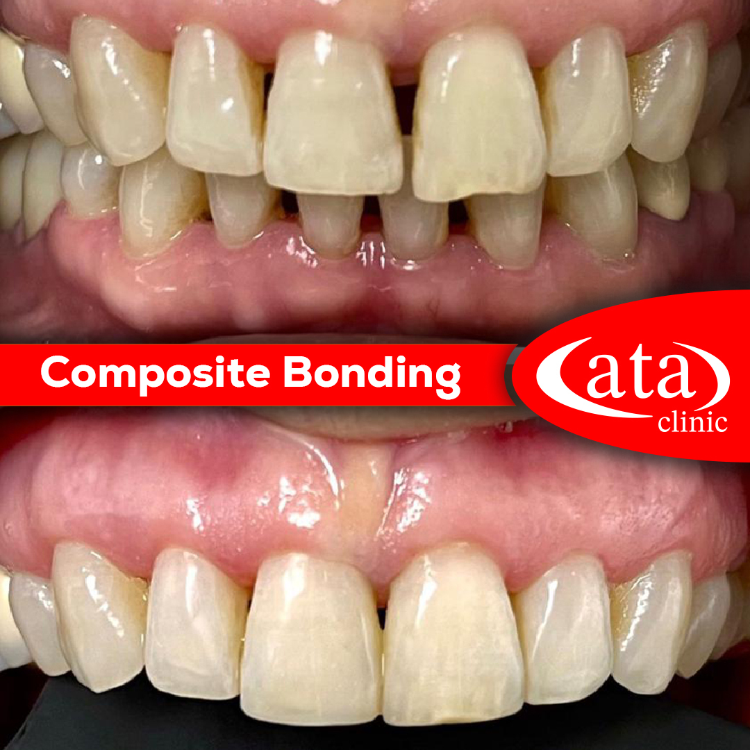Ata ConfiDental photo 4