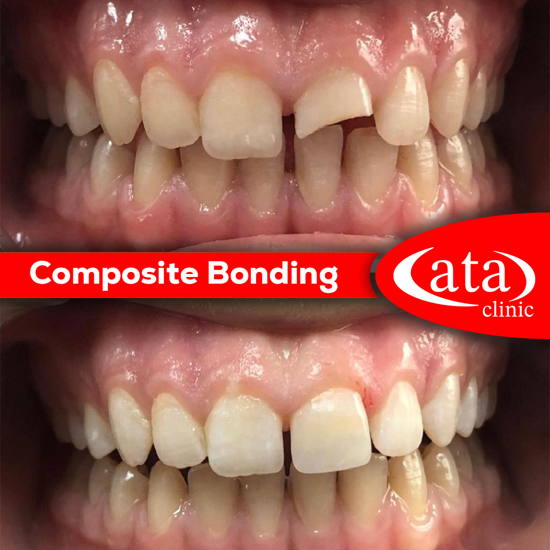 Ata ConfiDental photo 5
