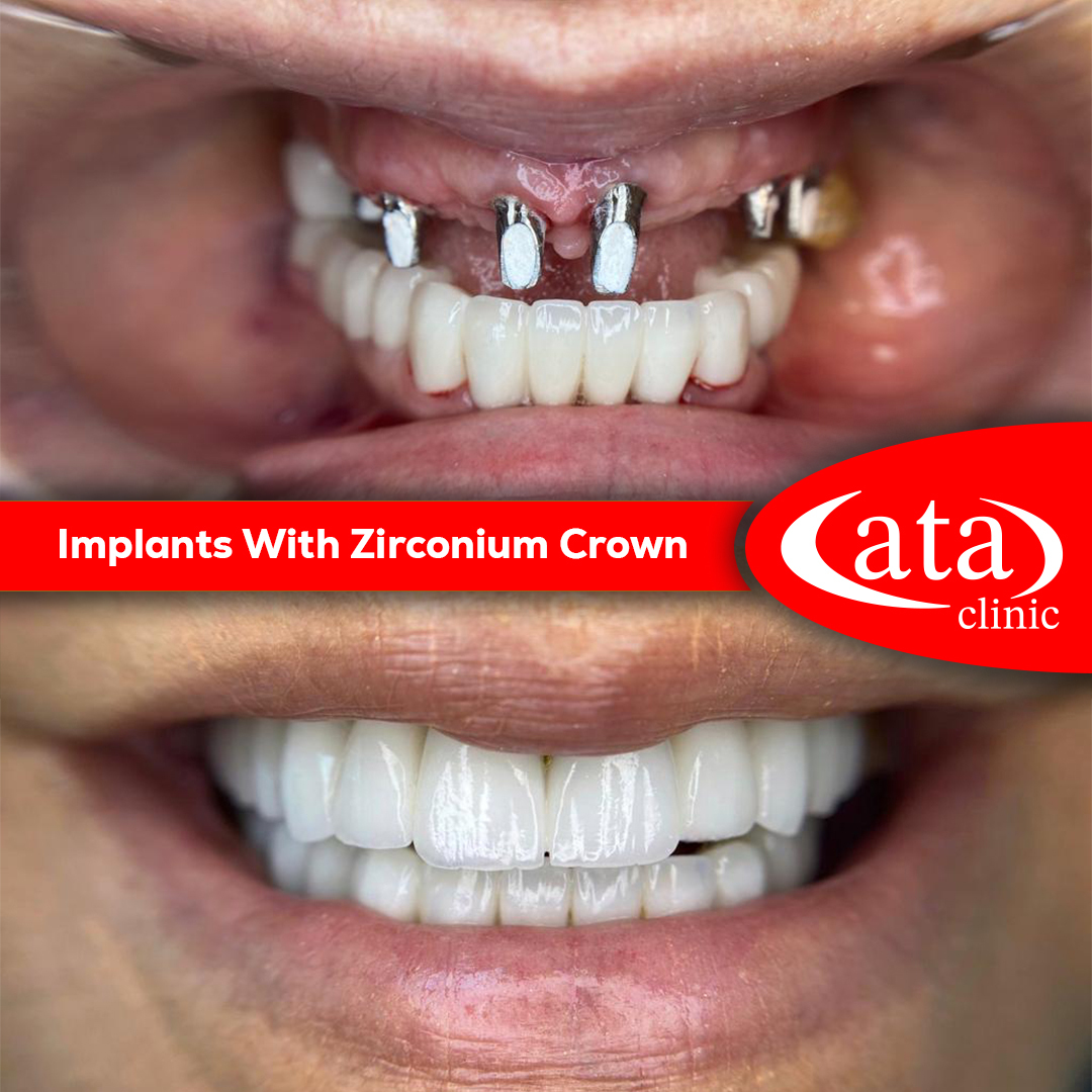 Ata ConfiDental photo 6