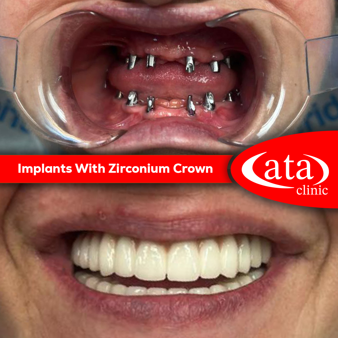 Ata ConfiDental photo 7
