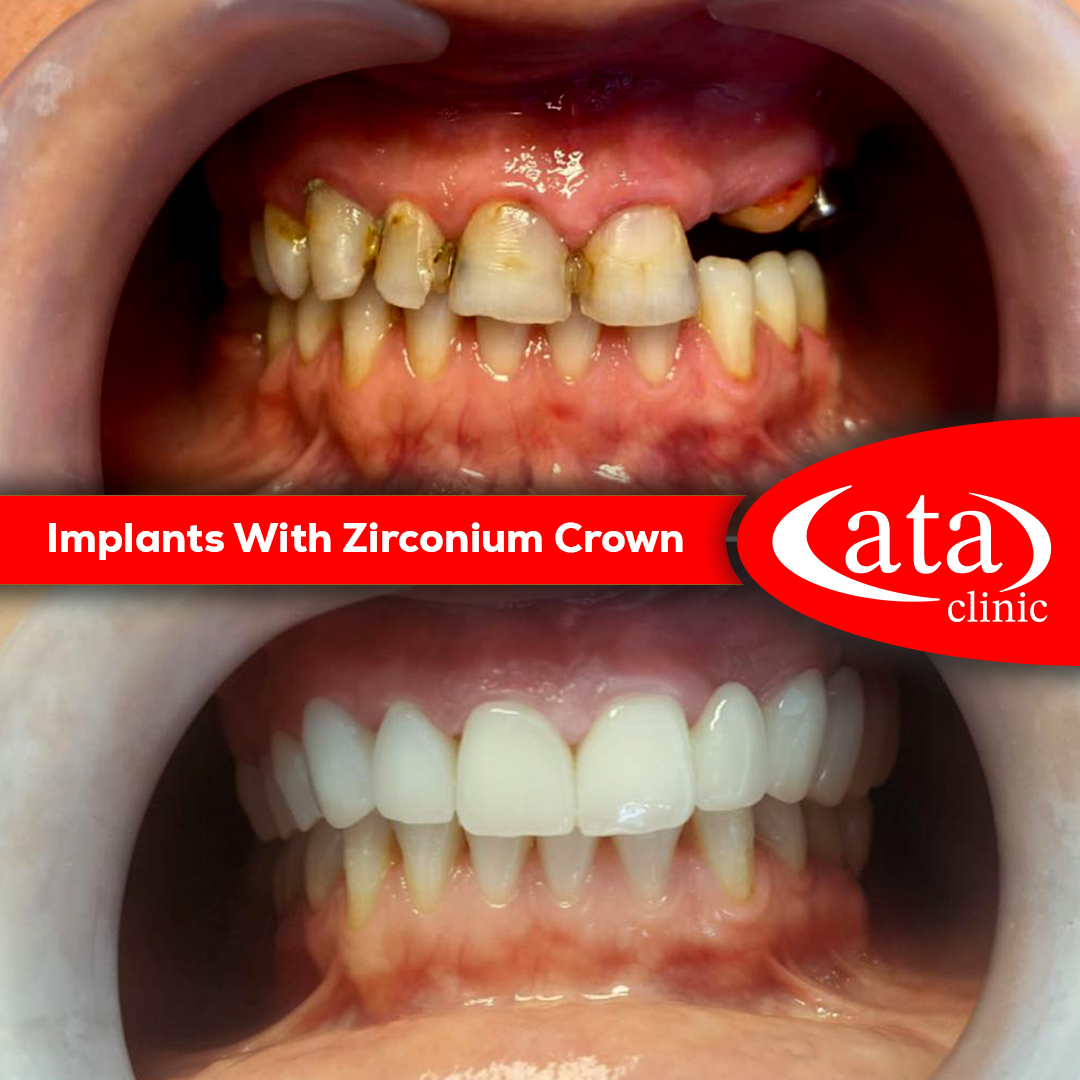 Ata ConfiDental photo 8