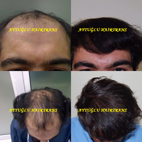 Aytuğlu Hairtrans photo 1