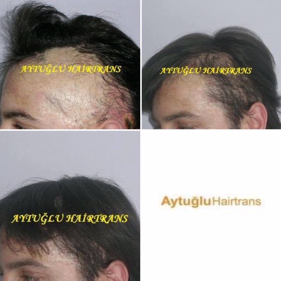 Aytuğlu Hairtrans photo 2