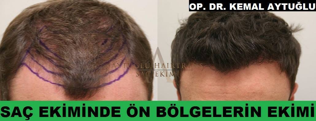 Aytuğlu Hairtrans photo 3