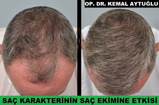 Aytuğlu Hairtrans photo 4