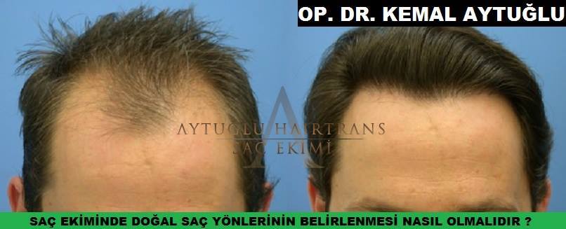 Aytuğlu Hairtrans photo 5
