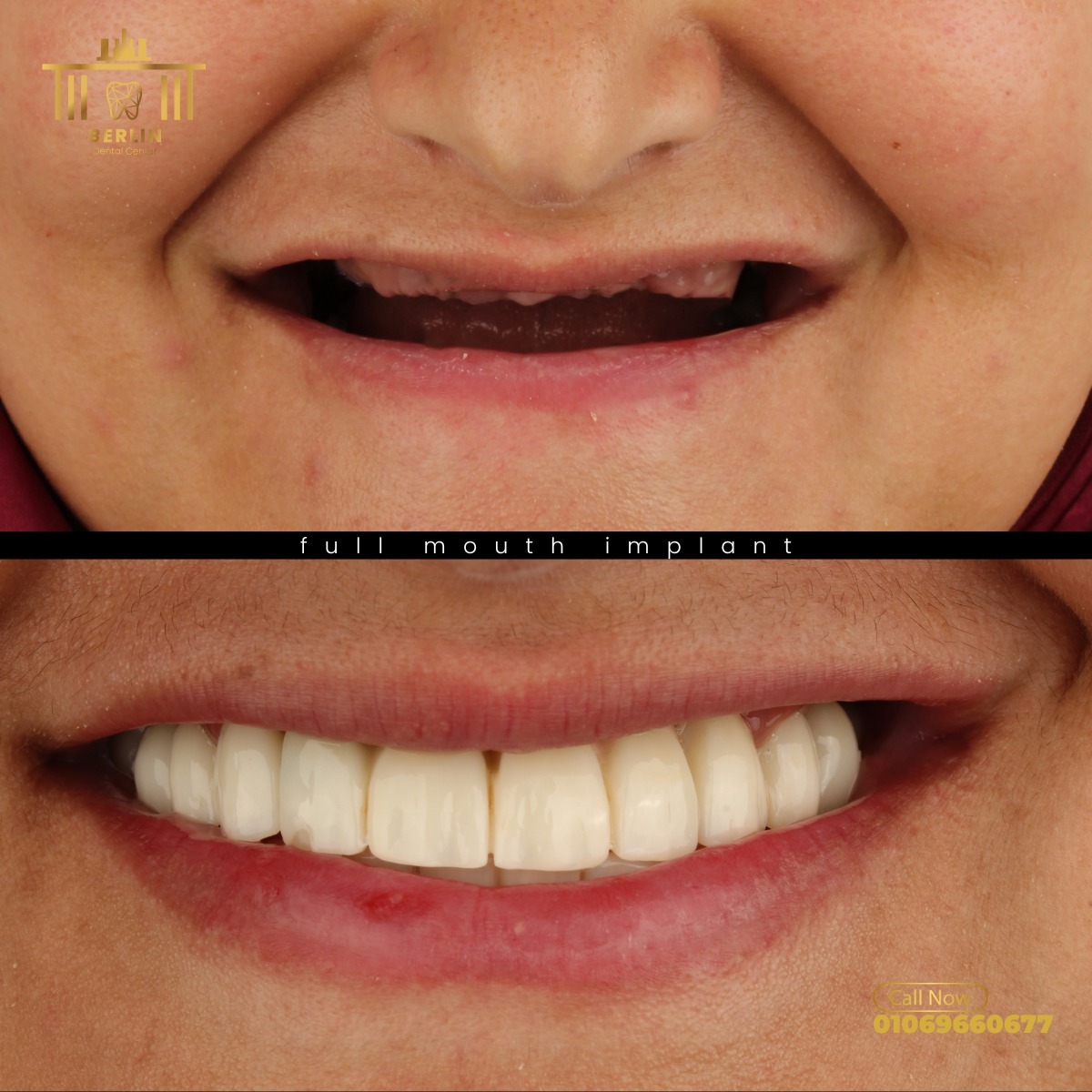 Berlin Dental Center photo 1