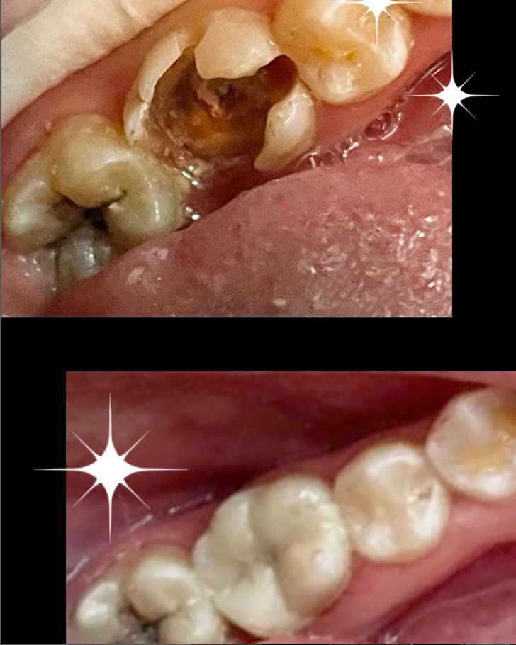 Bluetooth Dental Clinic photo 4