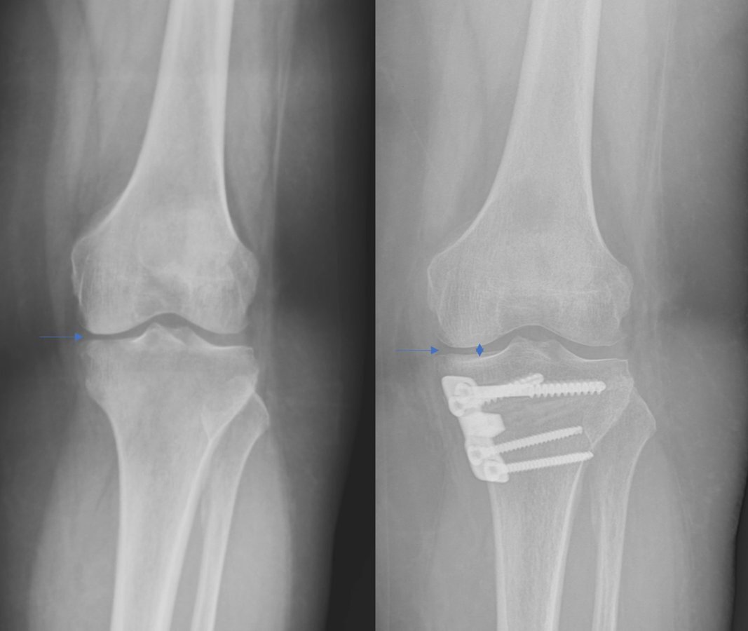 Caria Orthopaedics & Rehabilitation photo 5
