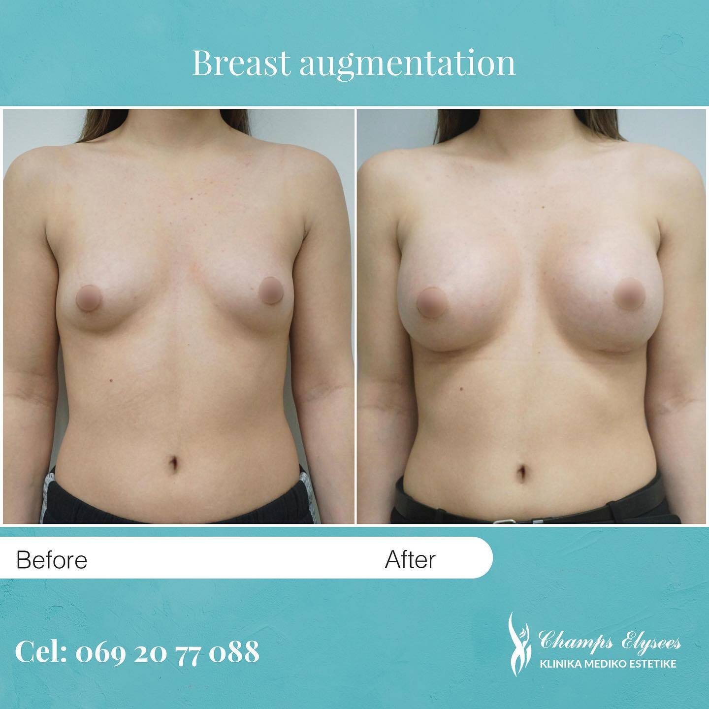 Champs Elysees - French Aesthetic Surgery photo 1