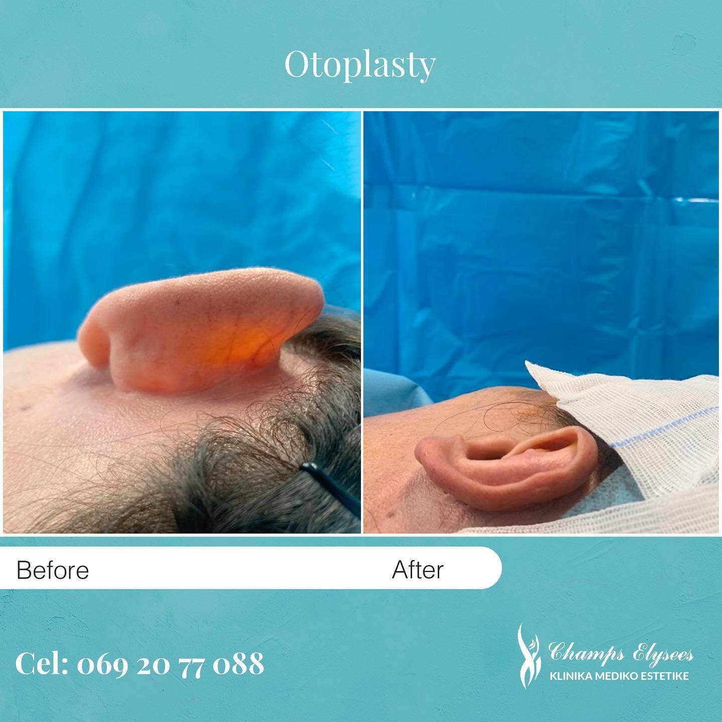 Champs Elysees - French Aesthetic Surgery photo 2