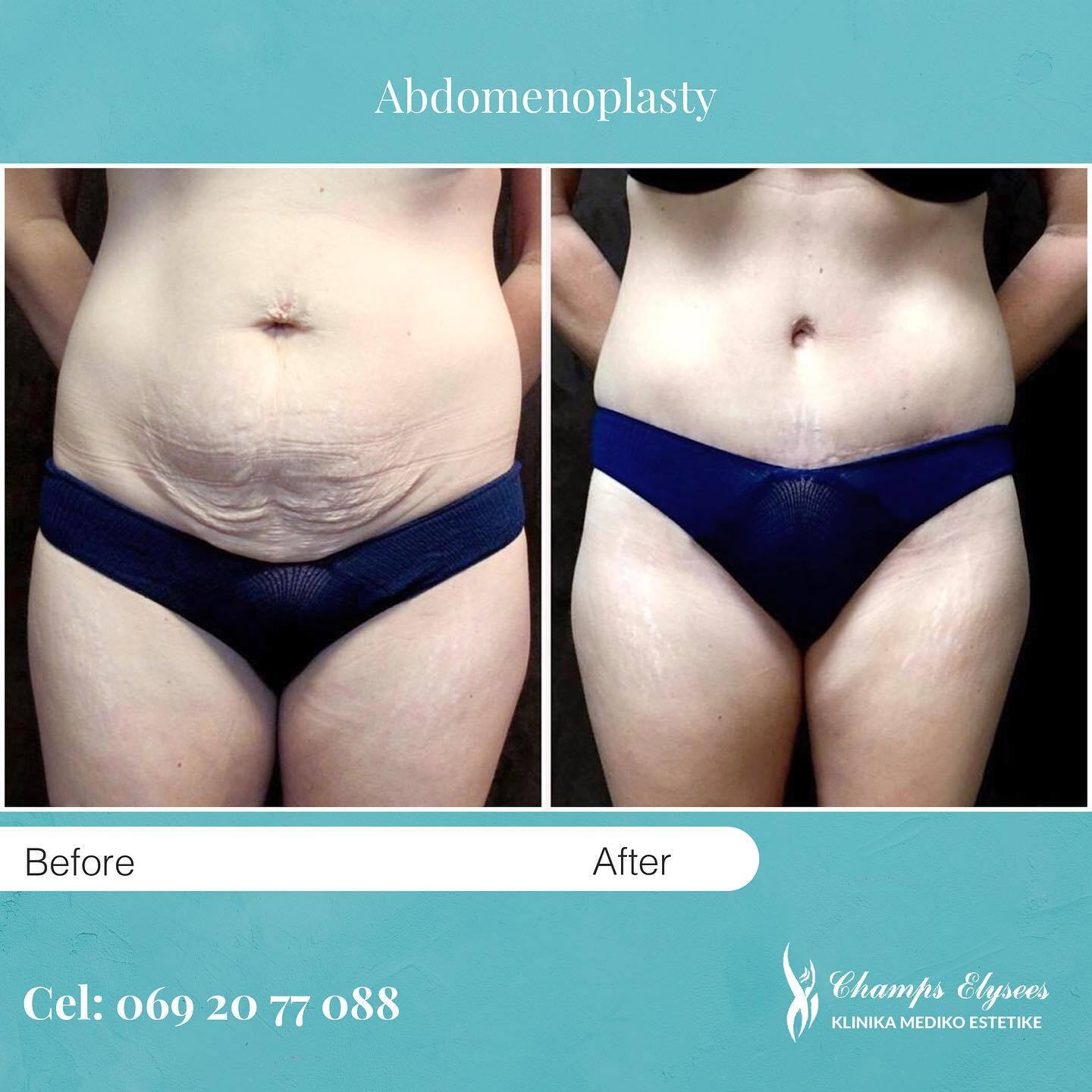 Champs Elysees - French Aesthetic Surgery photo 3