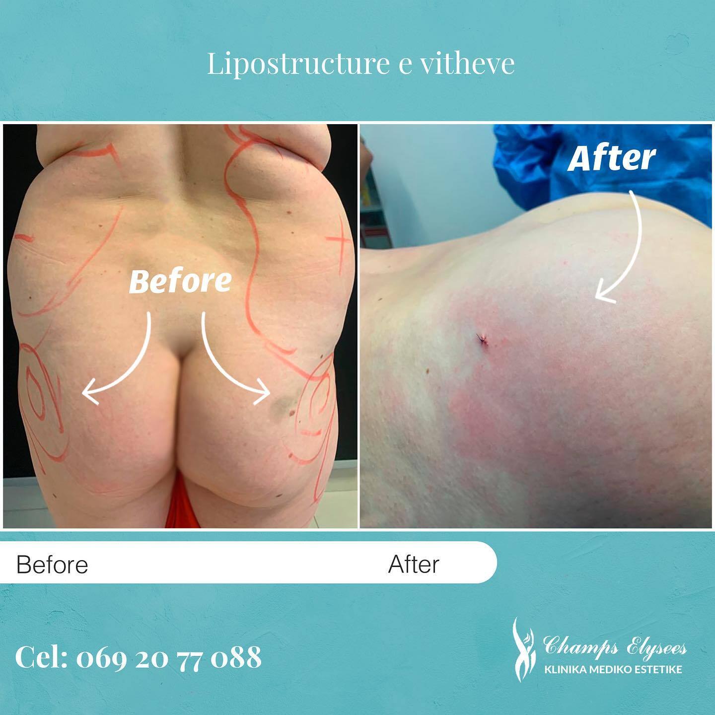 Champs Elysees - French Aesthetic Surgery photo 4
