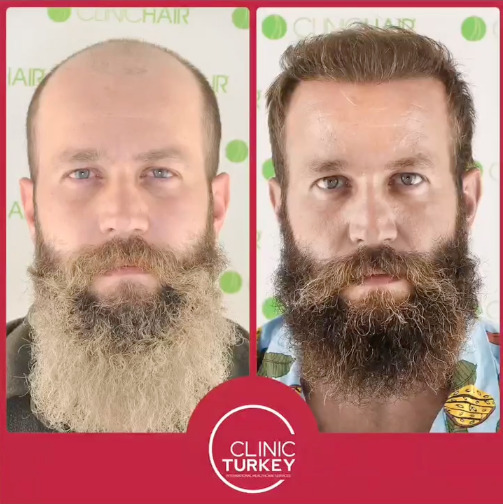 ClinicTurkey photo 1