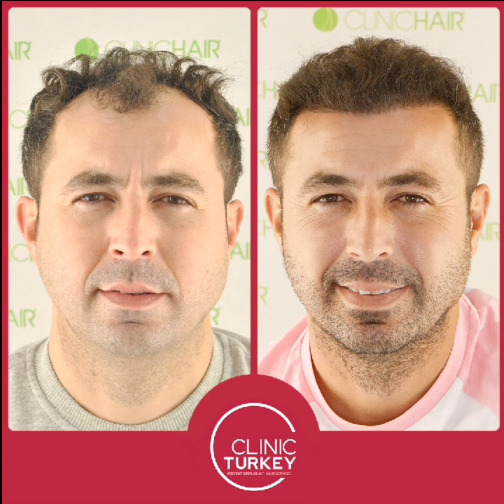 ClinicTurkey photo 2