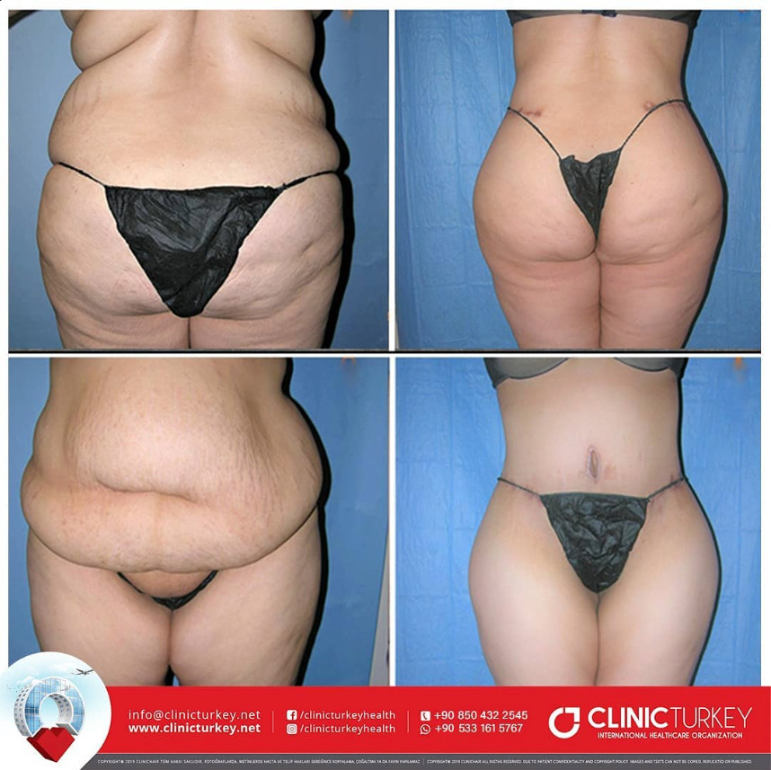 ClinicTurkey photo 4