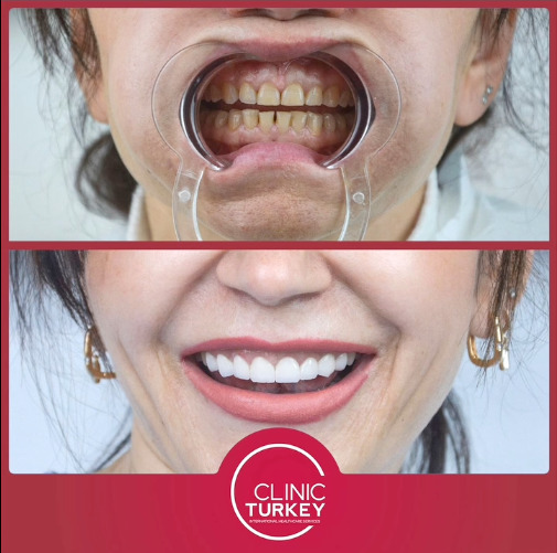 ClinicTurkey photo 5