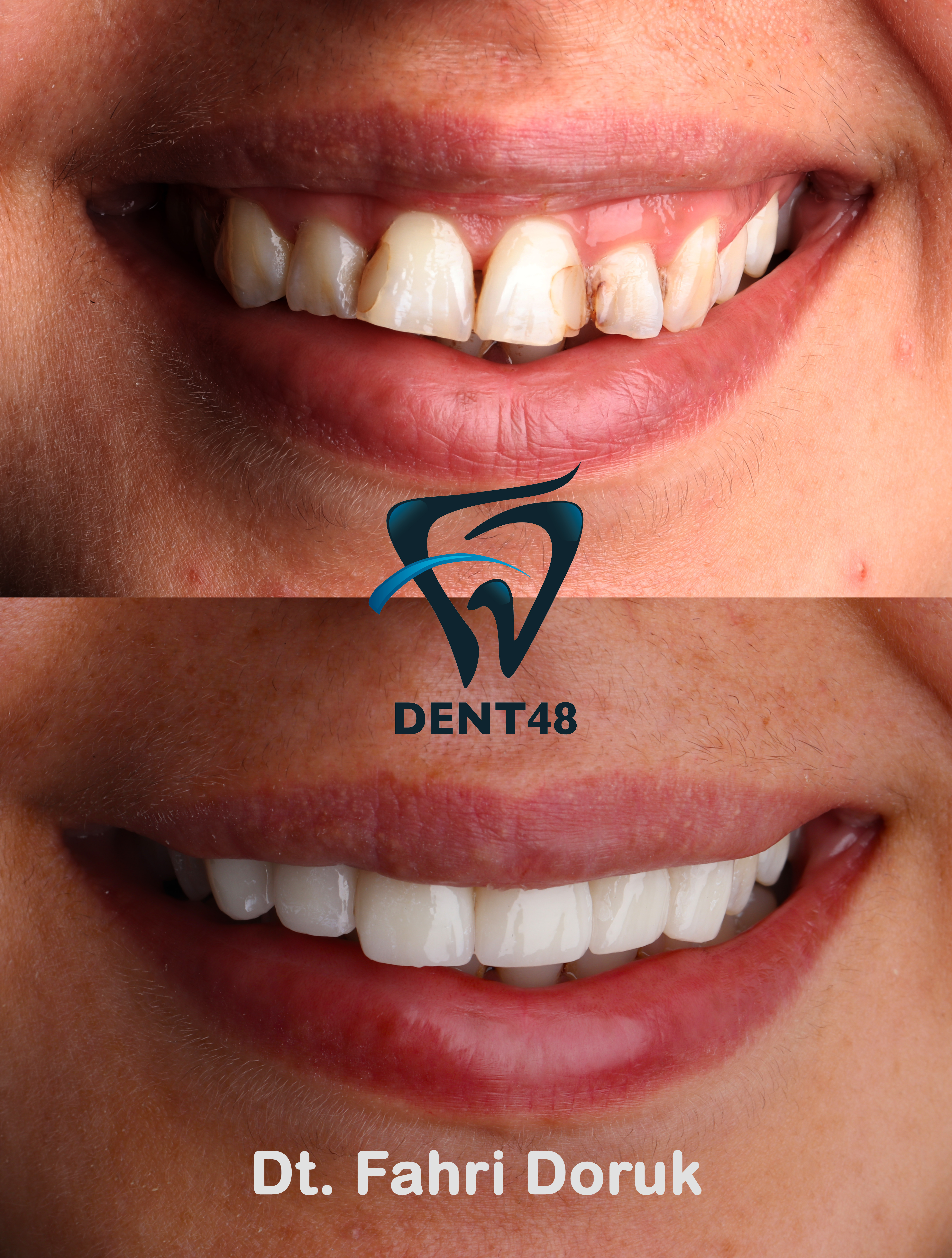 Dent 48 photo 1