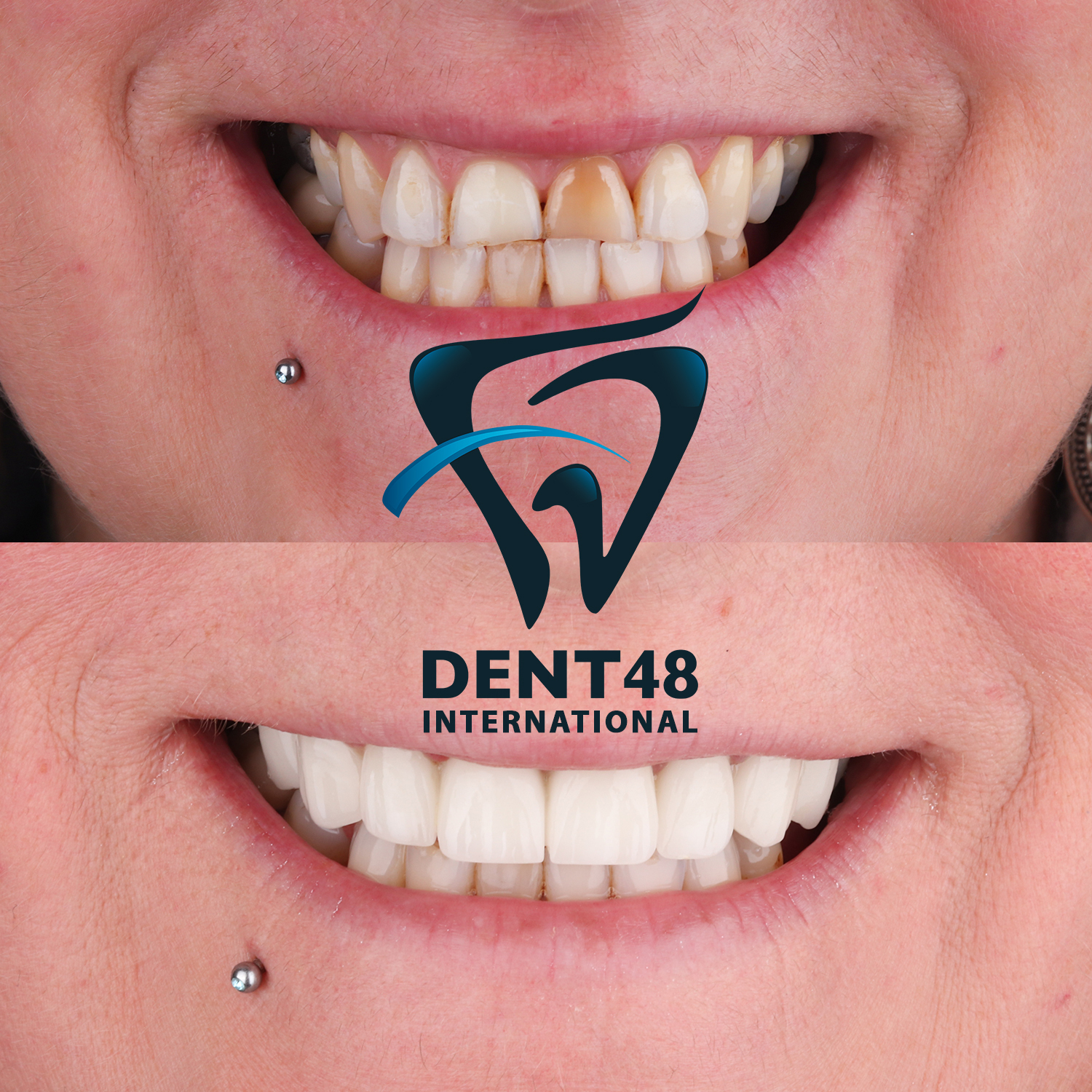 Dent 48 photo 2