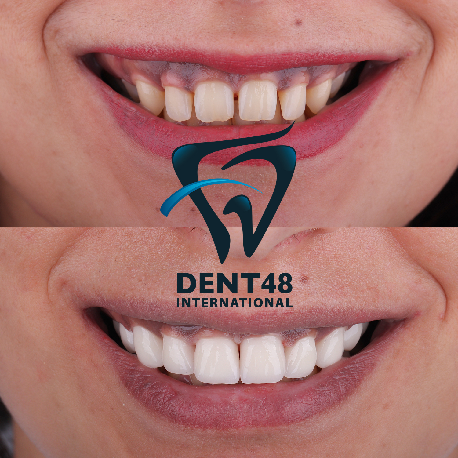 Dent 48 photo 3