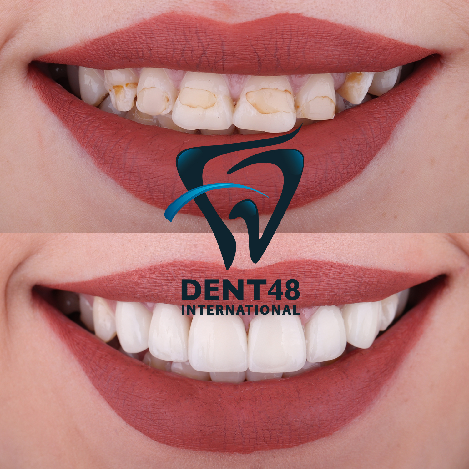 Dent 48 photo 4