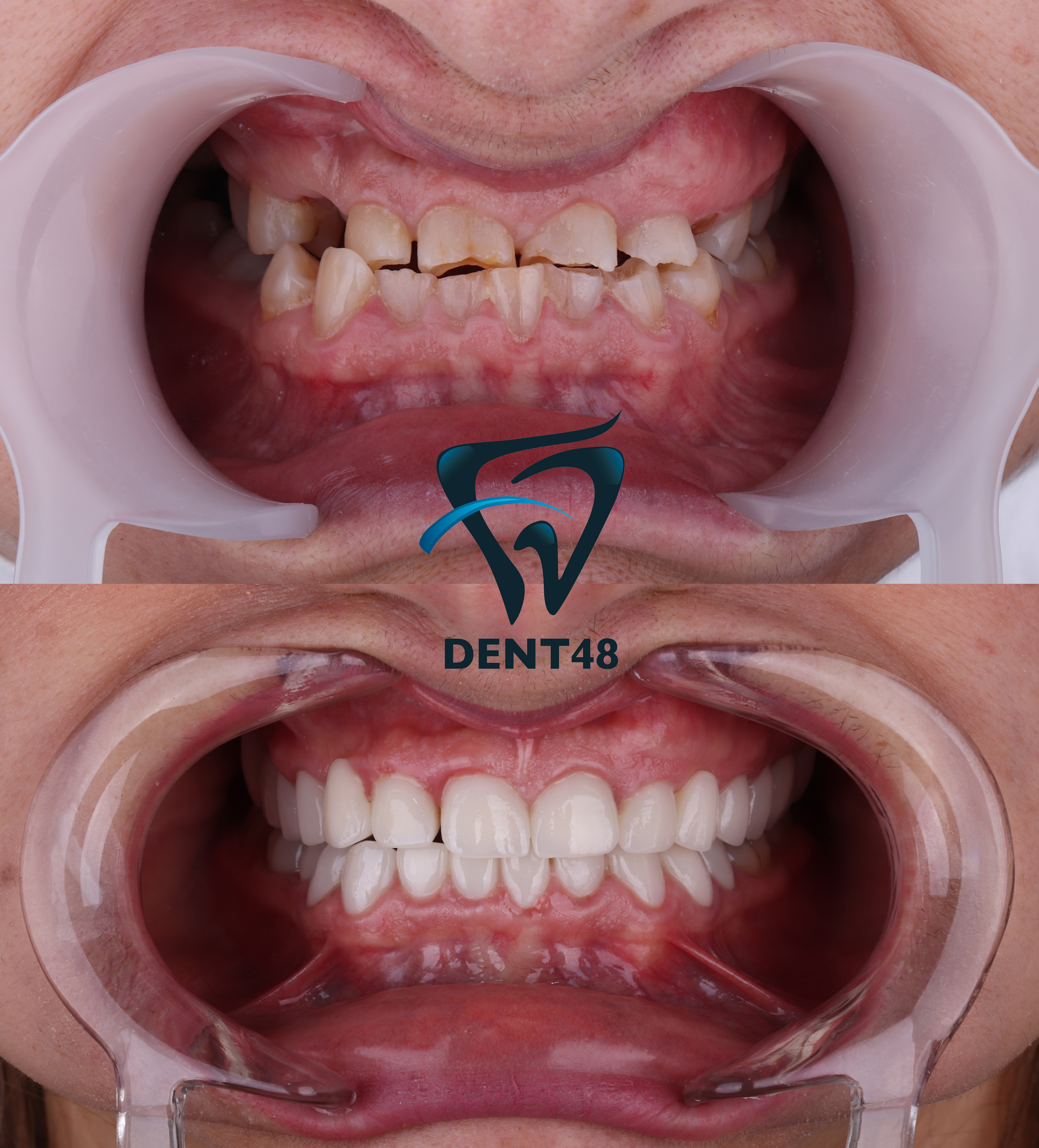 Dent 48 photo 5