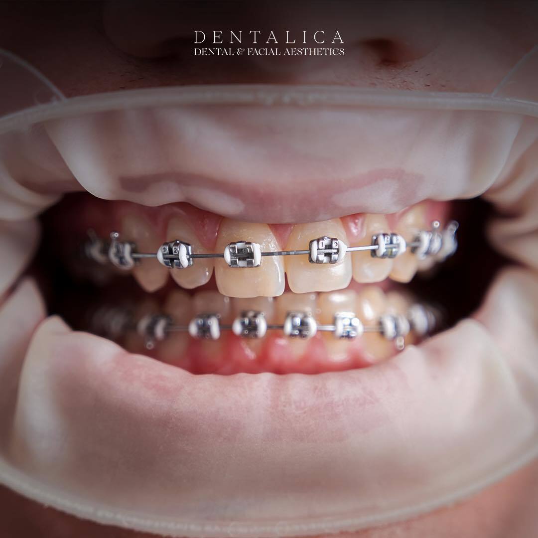 Dentalica Clinics photo 1