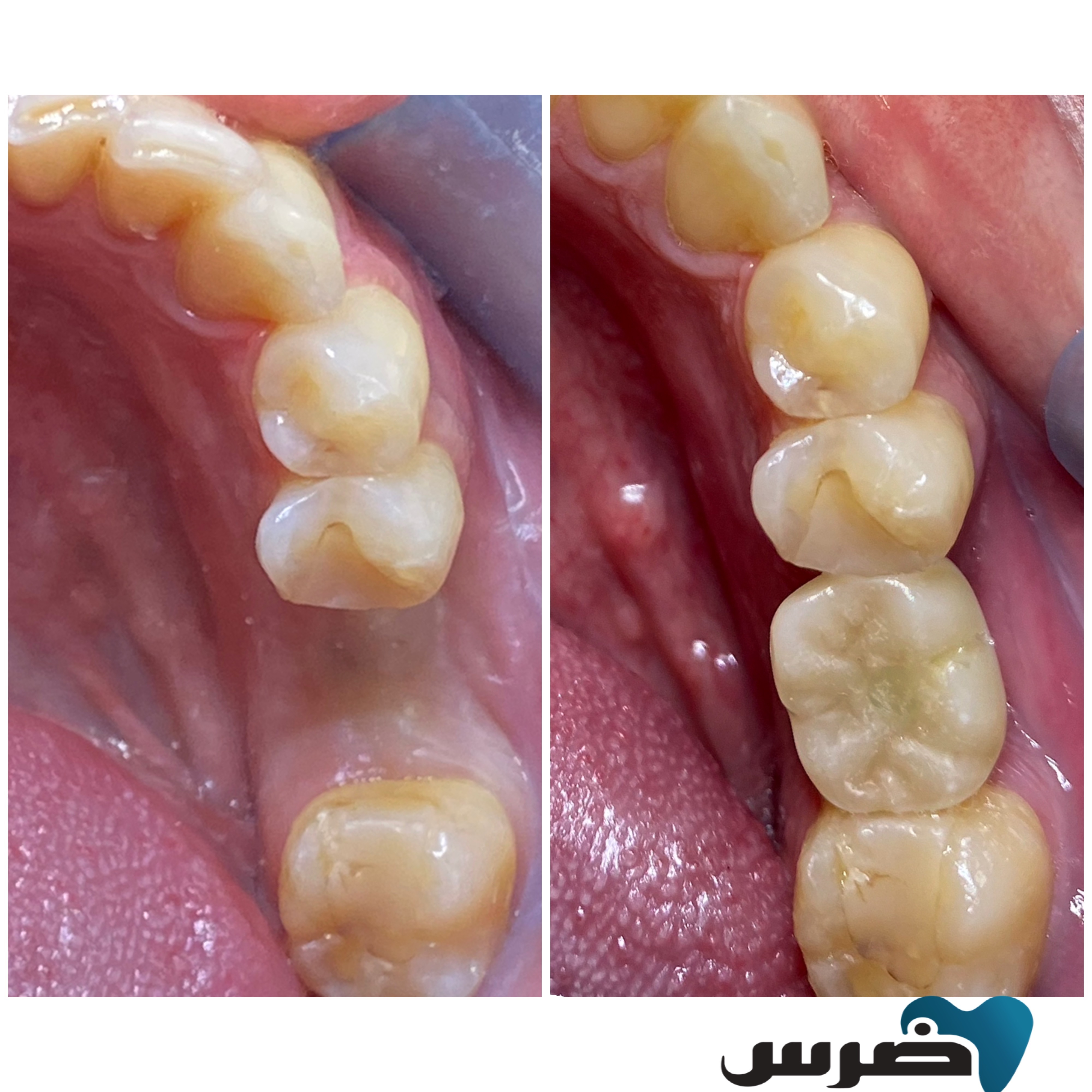 Ders Dental Clinic photo 3