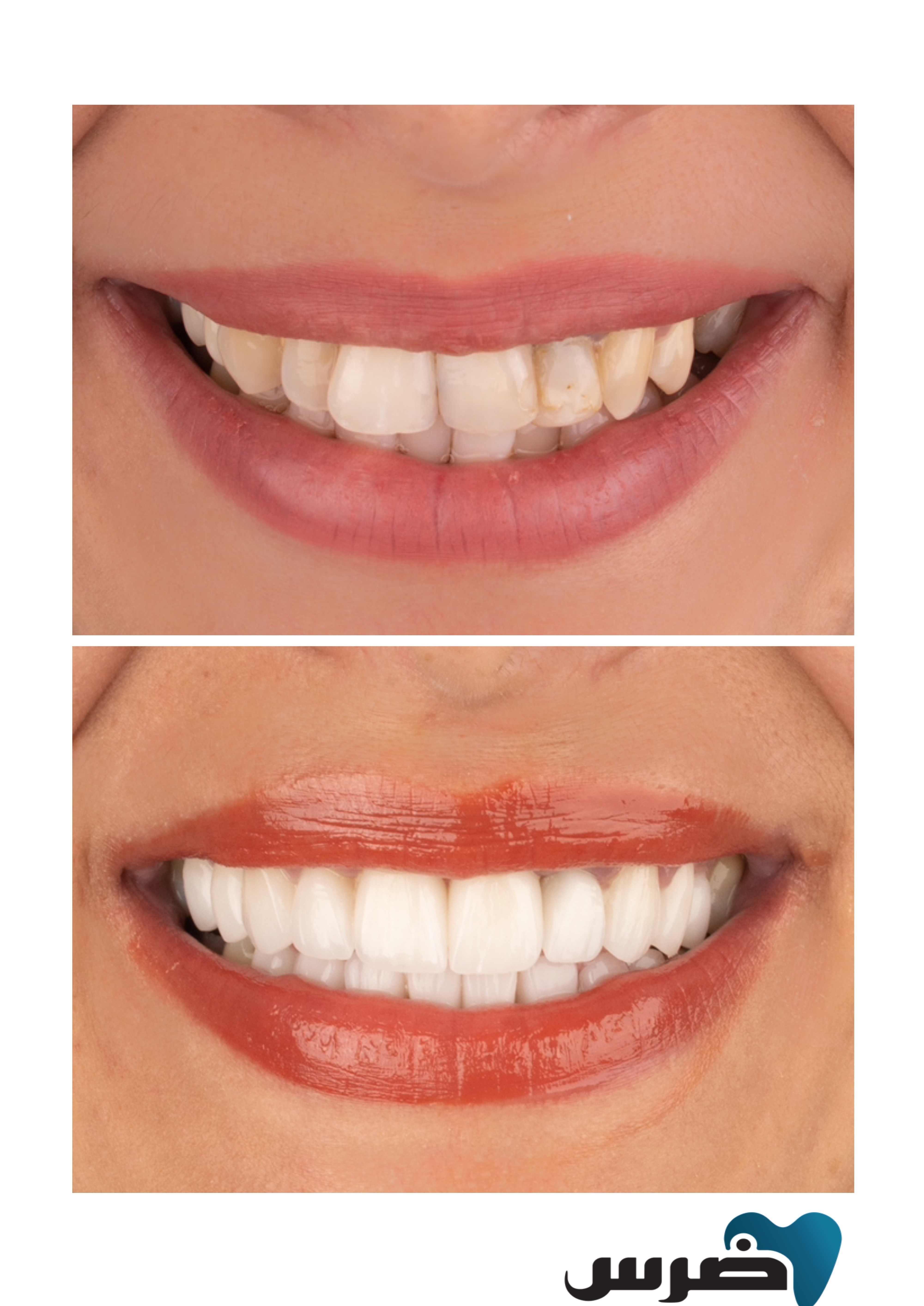 Ders Dental Clinic photo 4