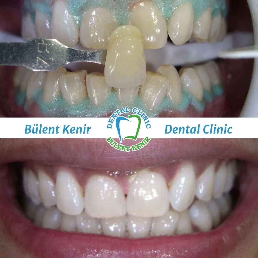 Dr. Bülent Kenir photo 1