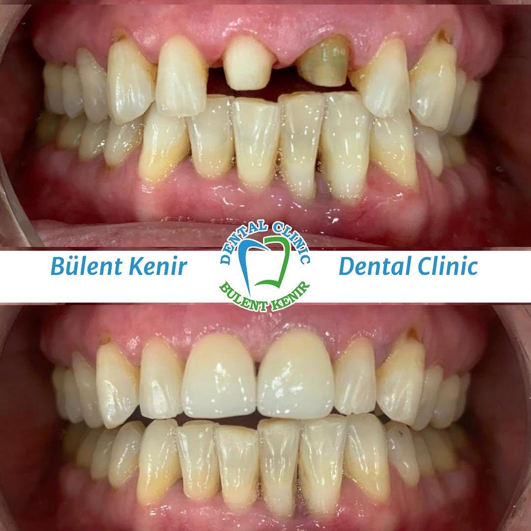 Dr. Bülent Kenir photo 2