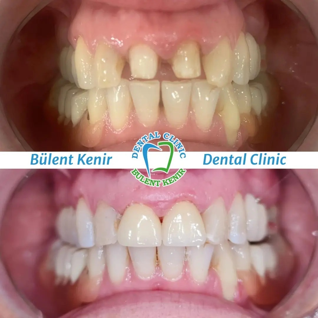 Dr. Bülent Kenir photo 3