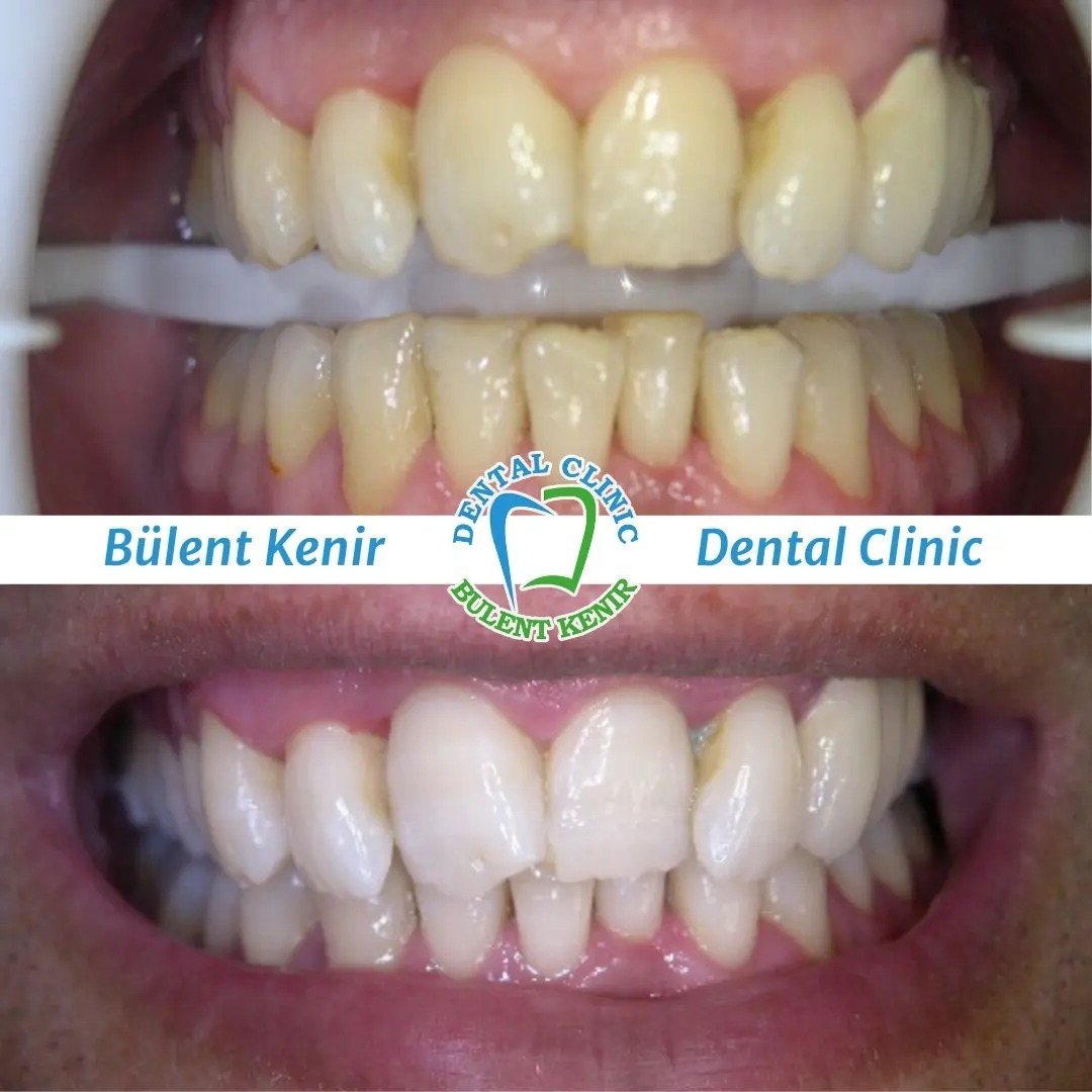 Dr. Bülent Kenir photo 4