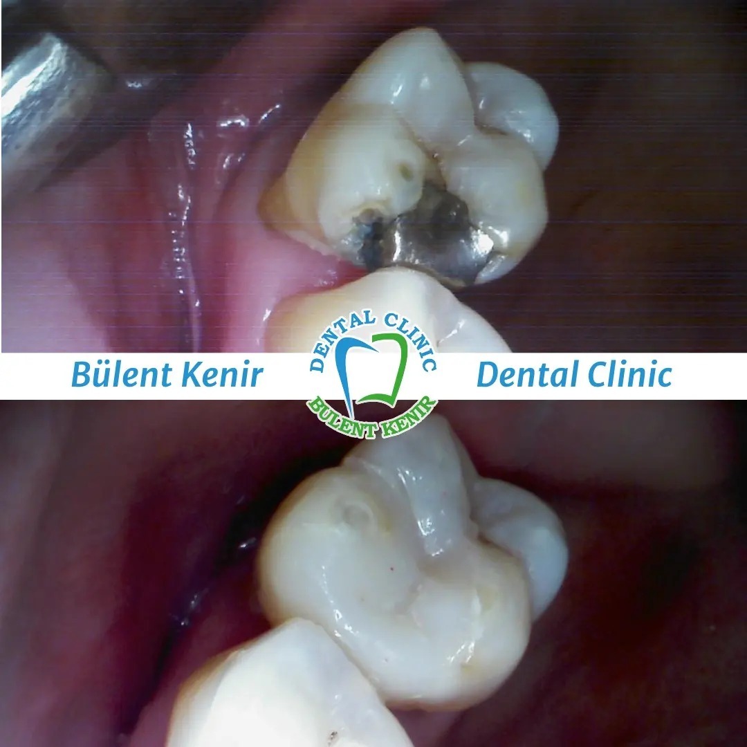 Dr. Bülent Kenir photo 5