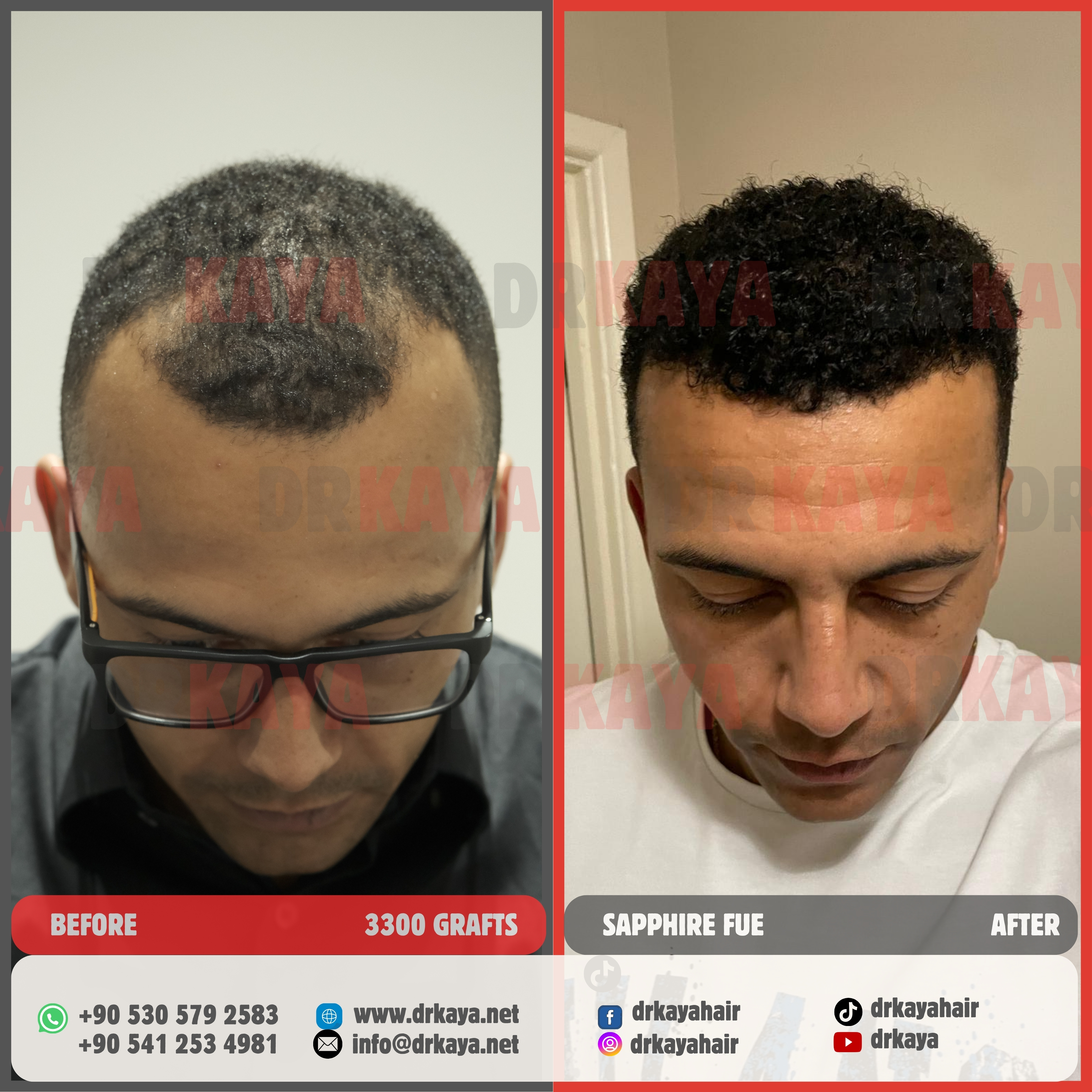DRKAYA Clinic photo 1