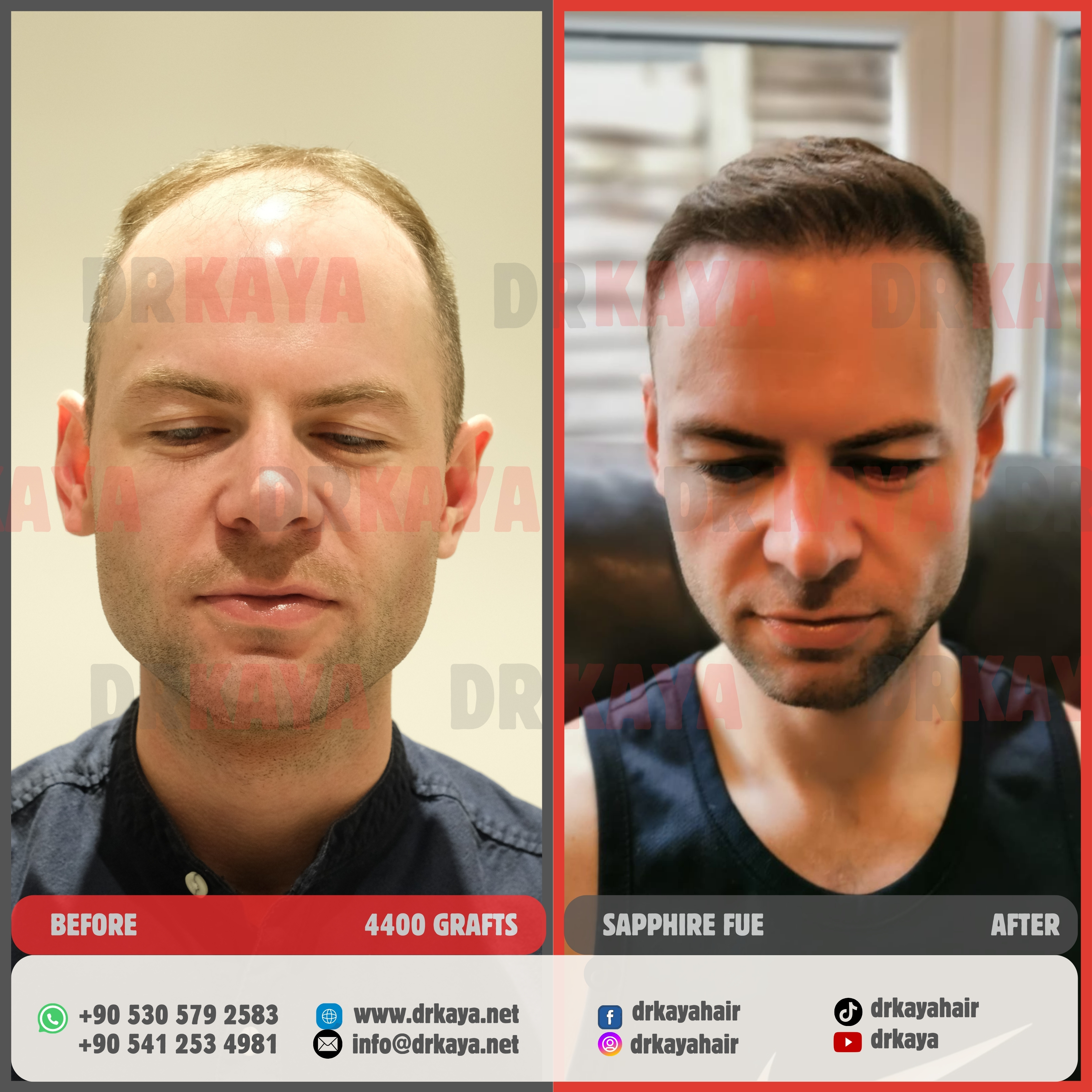 DRKAYA Clinic photo 4