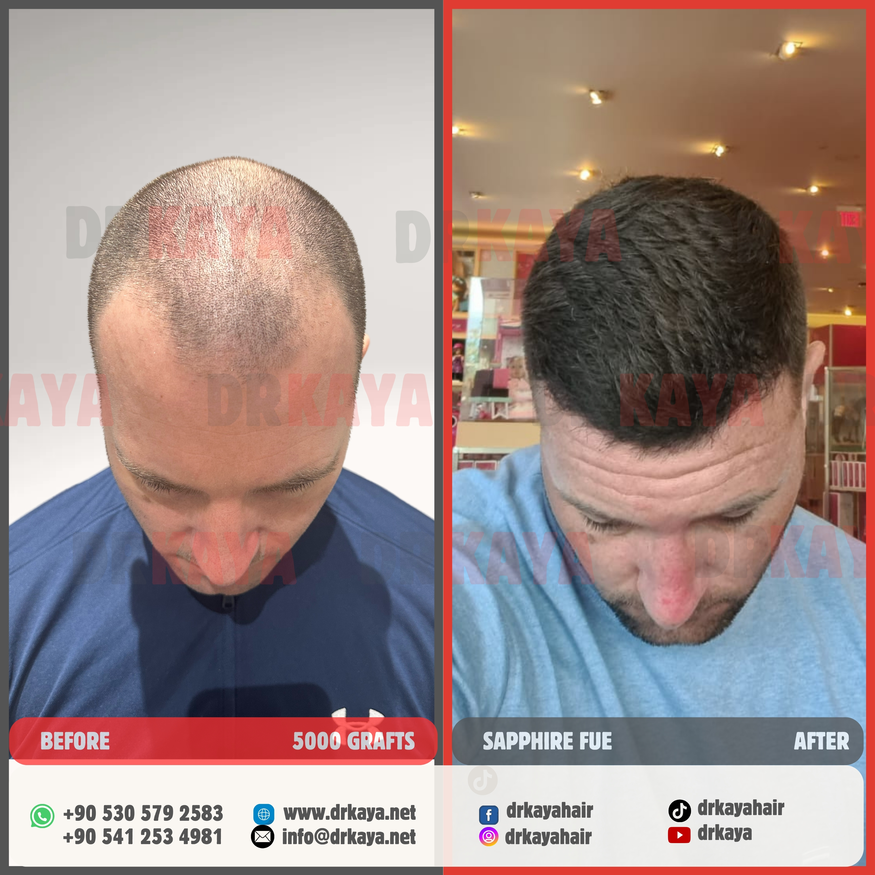 DRKAYA Clinic photo 5