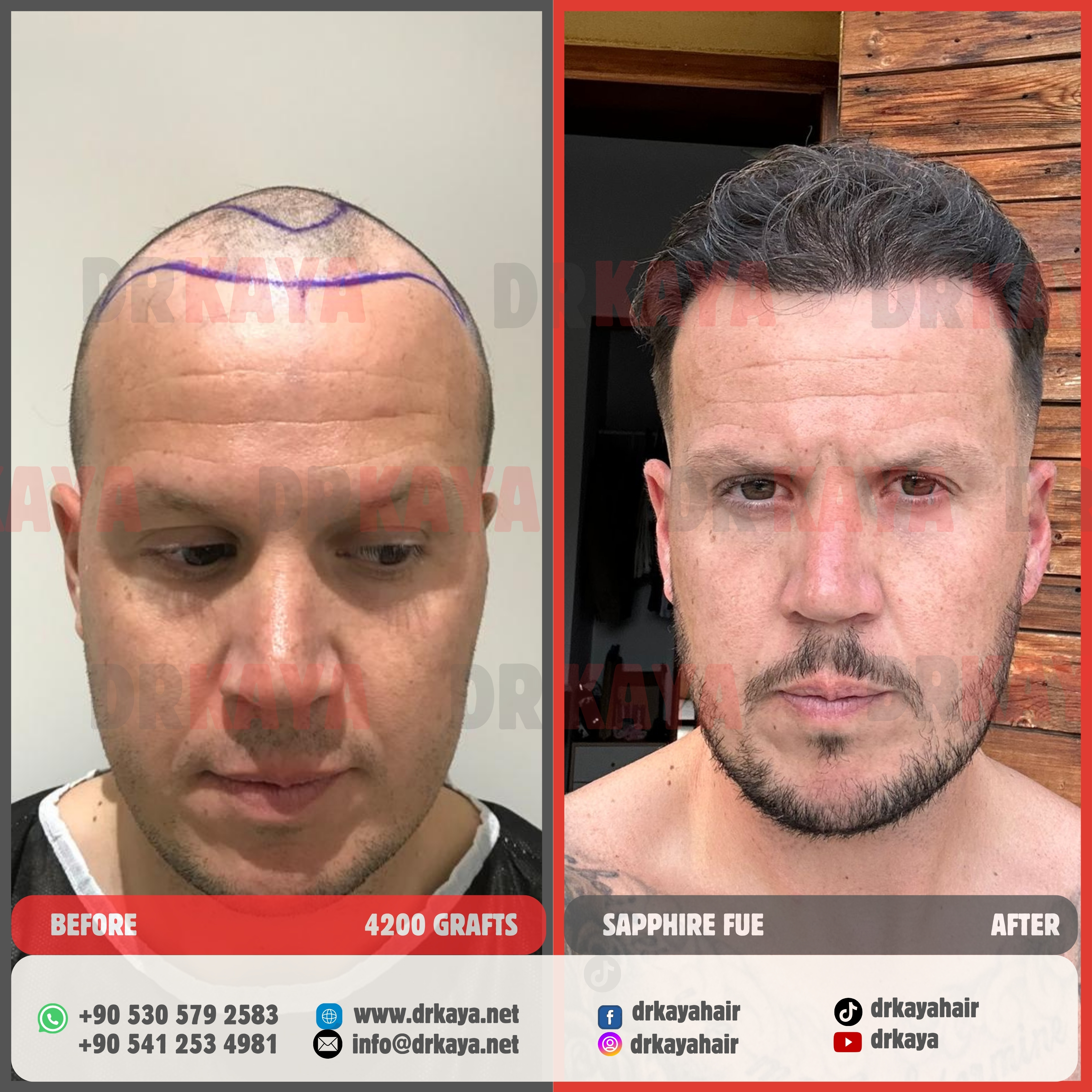 DRKAYA Clinic photo 6