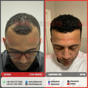 DRKAYA Clinic photo 7