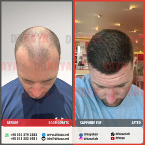 DRKAYA Clinic photo 11