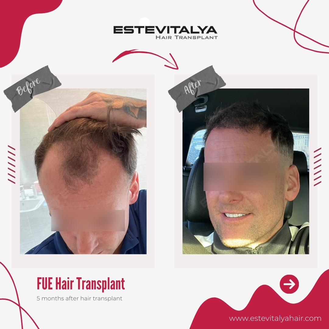 Estevitalya Hair photo 1