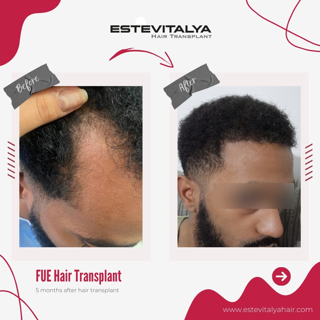 Estevitalya Hair photo 2
