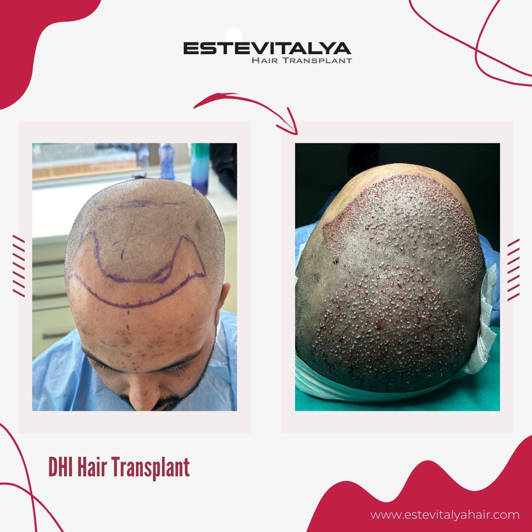 Estevitalya Hair photo 3