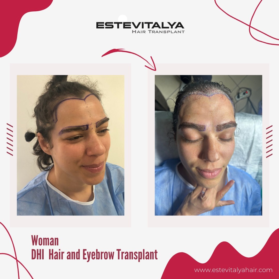 Estevitalya Hair photo 4