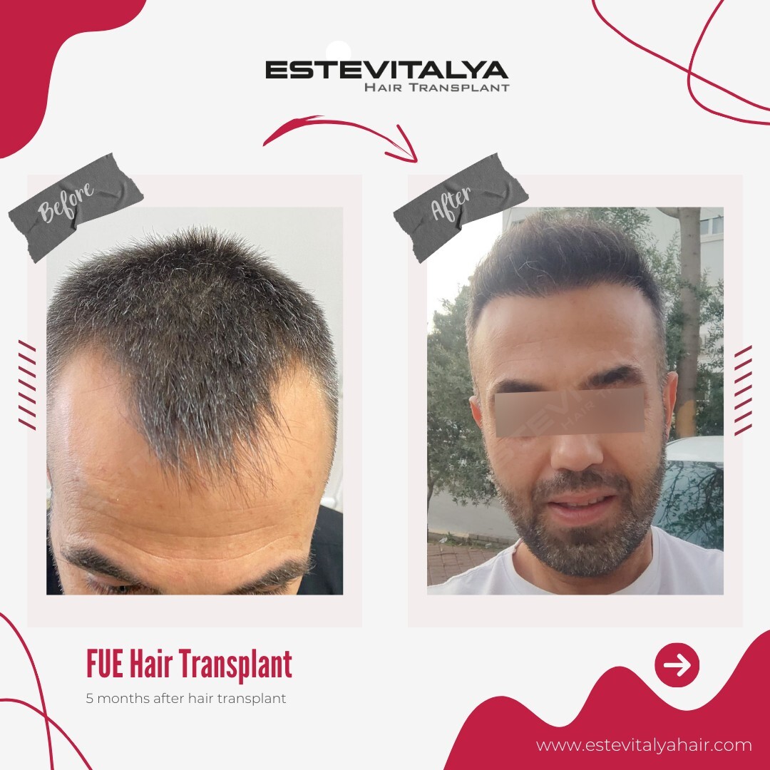 Estevitalya Hair photo 5