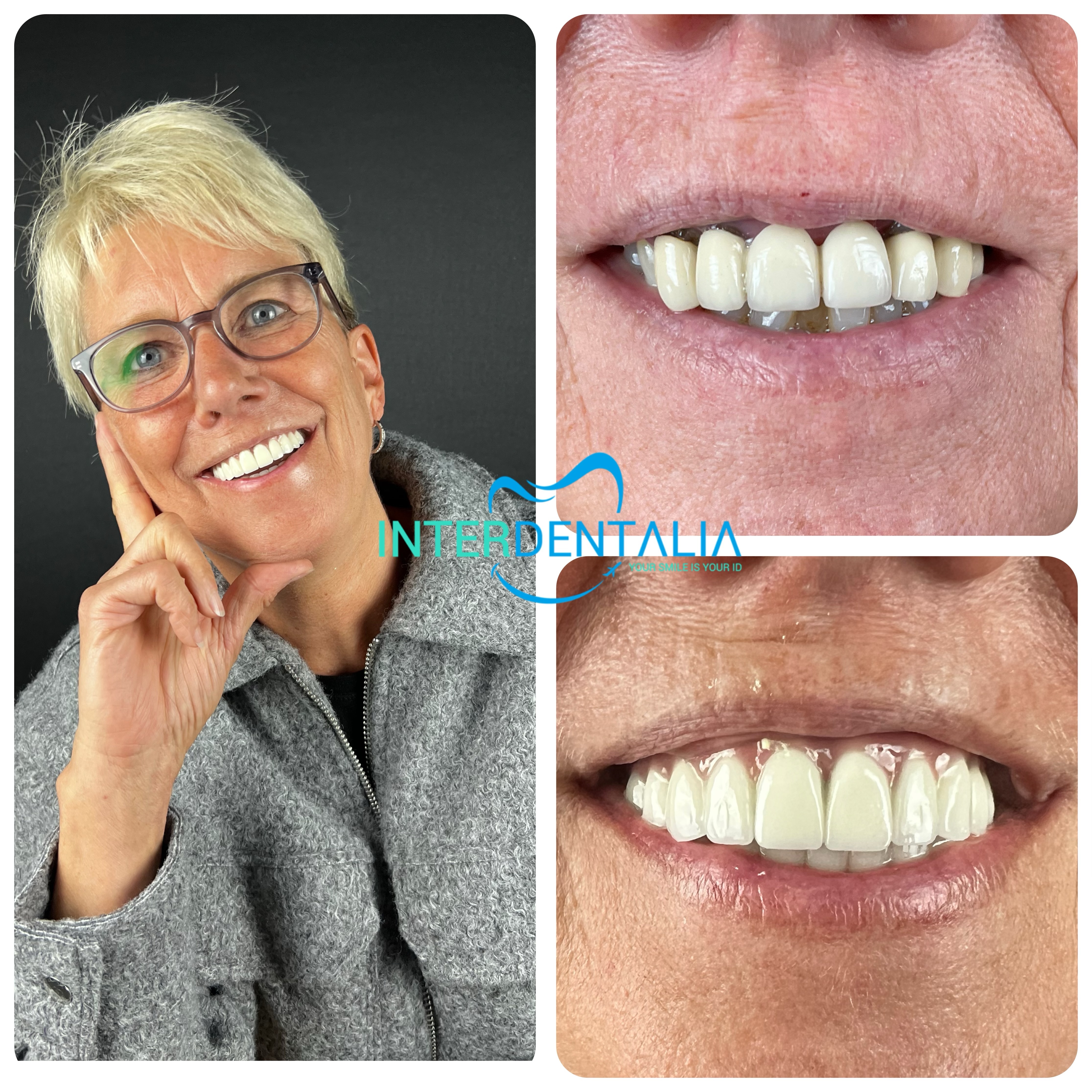 İnterdentalia Dental Clinic photo 1