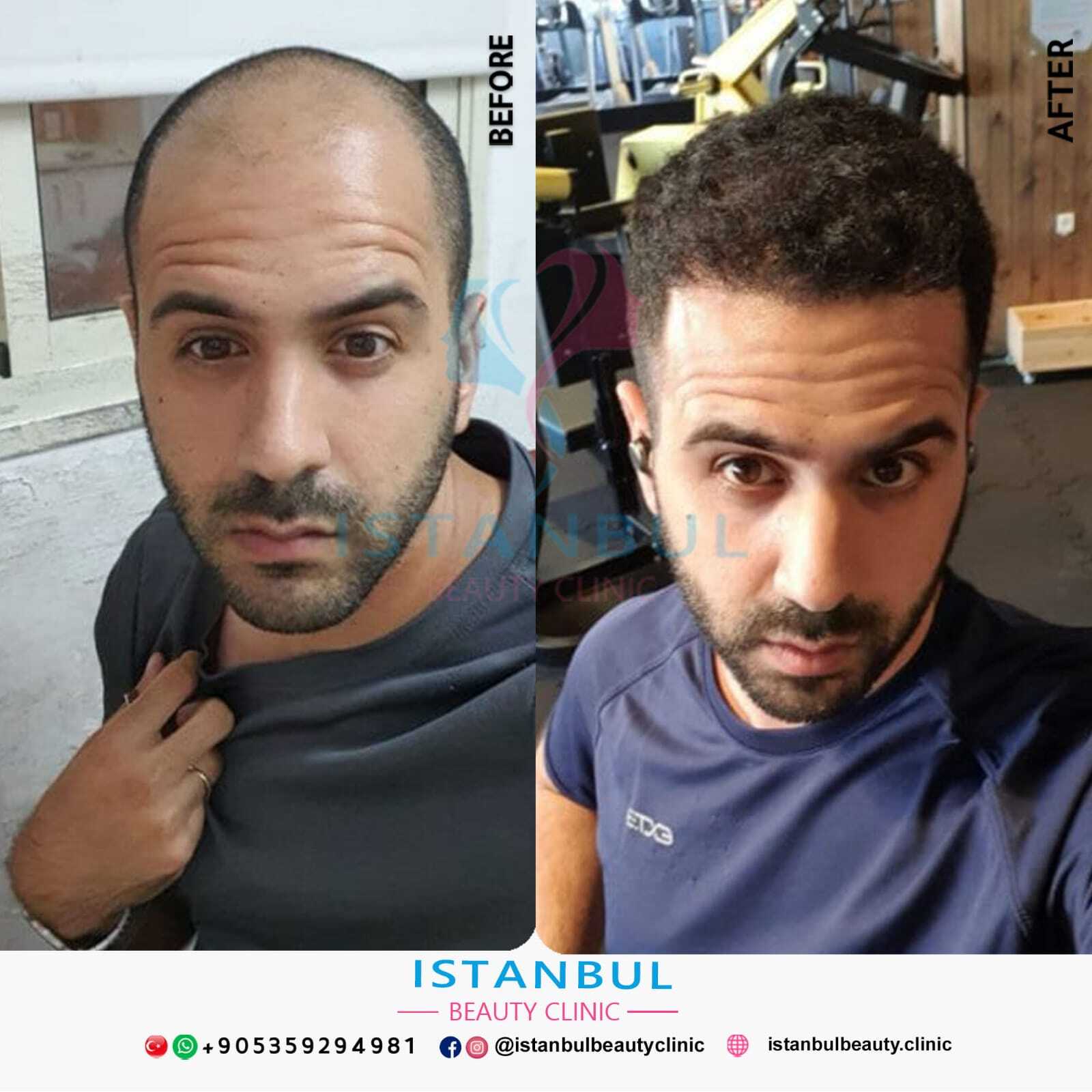 Istanbul Beauty Clinic photo 1